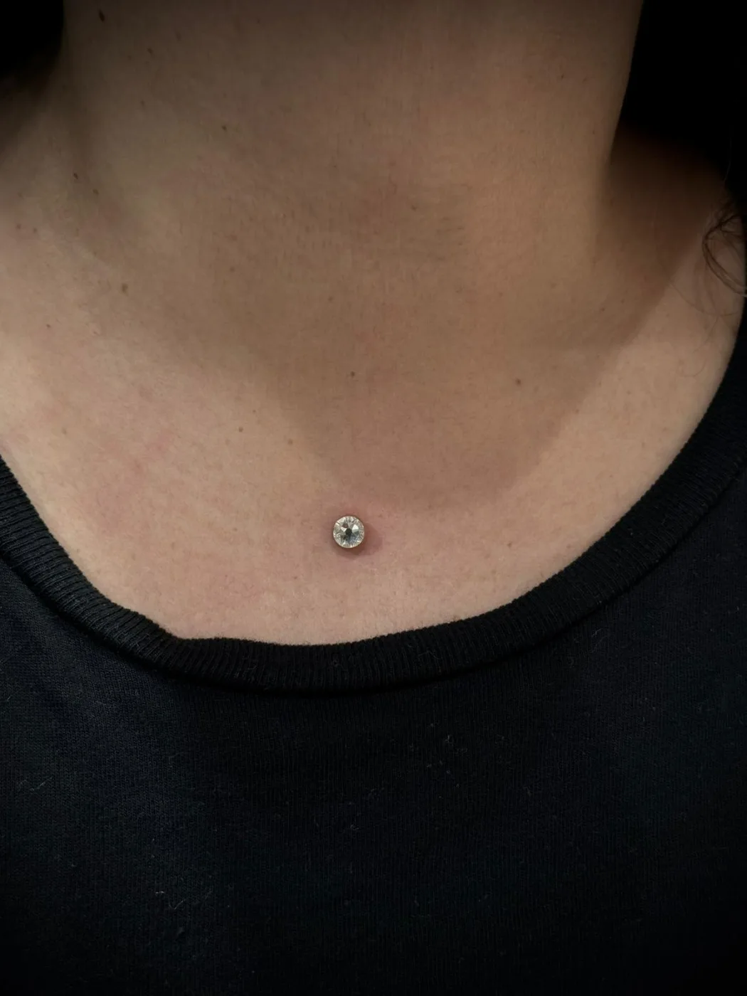 Dermal (Mikrodermal) Piercing